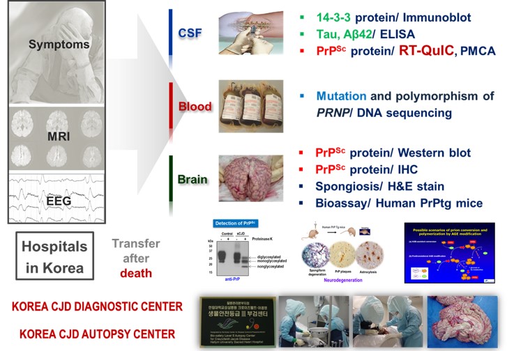 프리온질환 및 신경계바이러스연구